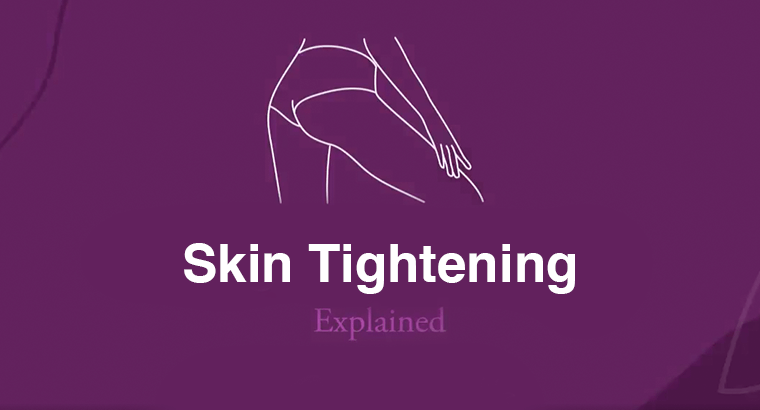 skin-tightning-explained