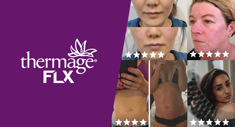 uitgelichte-afbeelding-reviews-thermage-FLX-V4