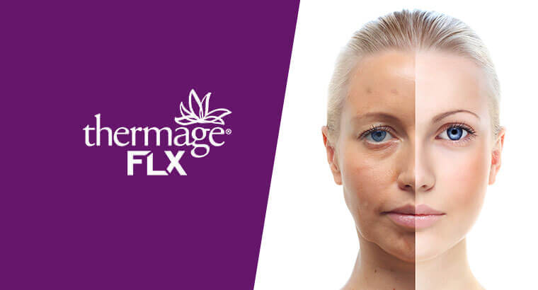 thermage-flx-age